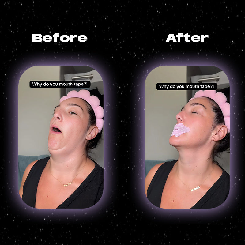 Mouth Tape-RS™